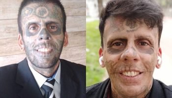 Leandro-de-Souza-comecou-o-processo-de-remocao-de-tatuagens